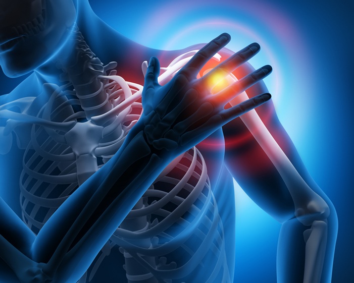SUBAKROMIALES IMPINGEMENT-SYNDROM